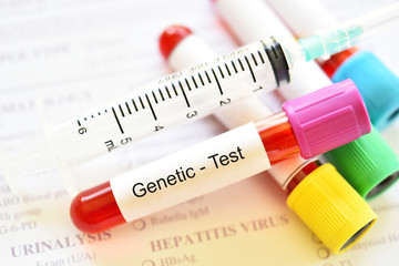 Test tube with blood sample for genetic testing