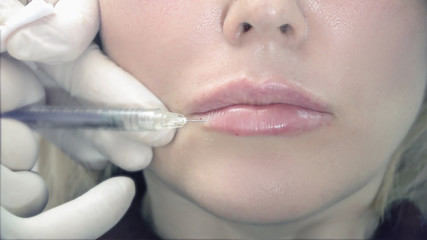 Beautiful Young Woman Getting Cosmetic Treatment Beauty Hyaluronic Lip Injection For Sexy Girl Lips.