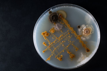 petri dish with bacteria, isolated on black