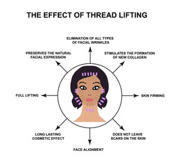 Fototapeta premium The effect of thread lifting. Threads for a facelift. Mesotherapy Wrinkles. Infographics. Vector illustration on isolated background.