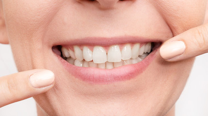 Smiling woman mouth with white teeth