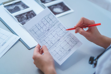 General practitioner examines electrocardiogram of patient during a health check and medical consultation. Healthcare and medicine. Diagnosis and treatment of the disease - obrazy, fototapety, plakaty