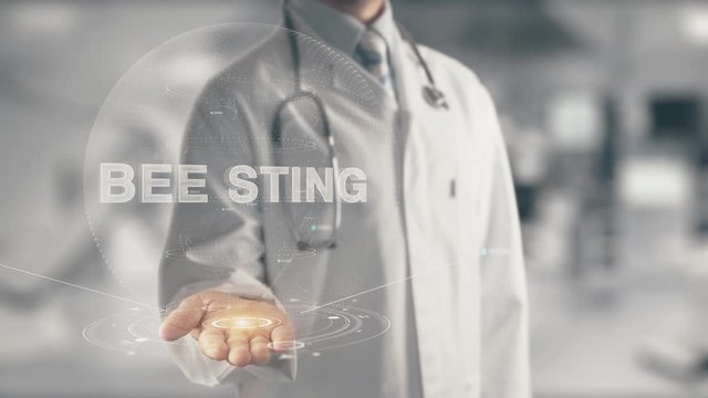 Doctor holding in hand Bee Sting