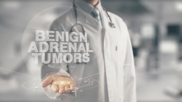 Doctor holding in hand Benign Adrenal Tumors