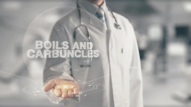 Doctor holding in hand Boils and Carbuncles