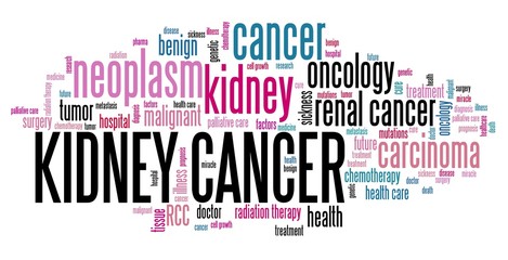 Obraz premium Oncology - Kidney cancer