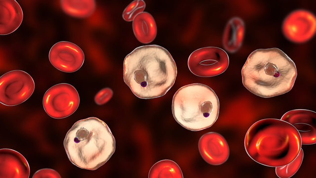 Blood smear in malaria patient. Plasmodium vivax inside red blood cell in the stage of ring-form trophozoite, the causative agent of malaria disease, 3D illustration