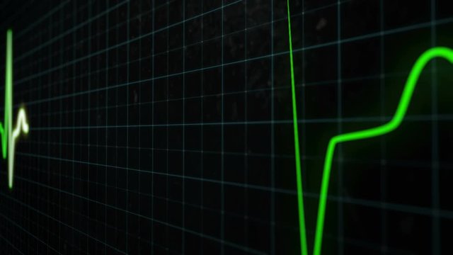 Heart rate chart, a medical screen of healthy heart rate in close-up, seamlessly loop footage. A bright green line shows the heart rate in real-time on monitor with grid lines.