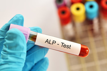 Blood sample tube for ALP or alkaline phosphatase enzyme test