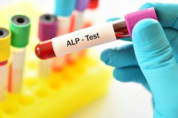 Blood sample tube for ALP or alkaline phosphatase enzyme test