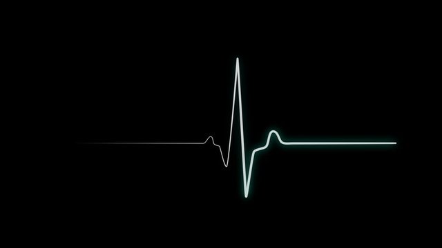 Cardiac arrest on the medical monitor, heart stops beating. Heart beating then hearts deadline on black background. Seamlessly loop footage.