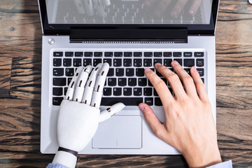 Man With Prosthetic Hand Working On Laptop