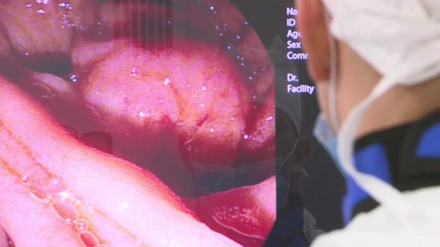Doctors use medical instruments and video cameras to perform abdominal surgery .