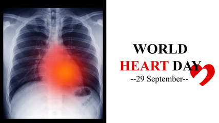 Film X ray(CXR) of chest and heart anatomy. Word heart day on 29 September annually aim to alert of cardiovascular heart disease awareness and prevention. Medical campaign day concept 