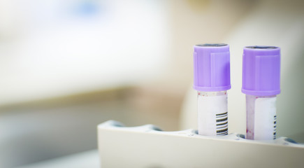EDTA test tube compleate blood count testing.