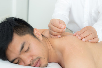 The doctor provided acupuncture for patients.