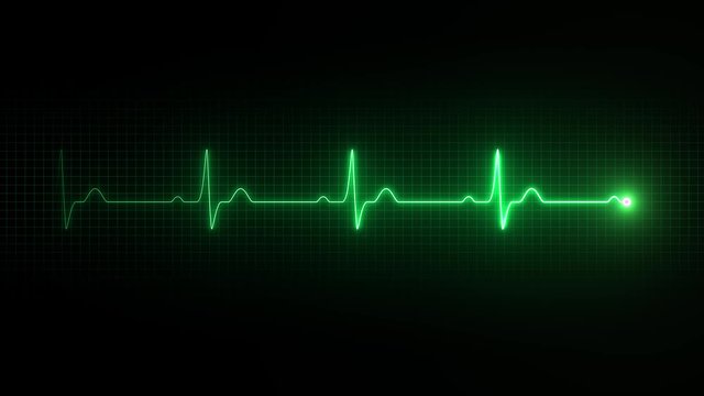 Cardiogram. Cardiogram curve on screen