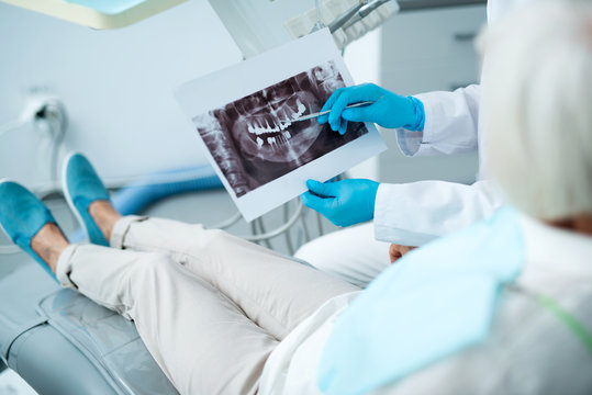 Dentist is analysing x-ray with adult woman