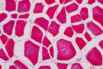 Education anatomy and Histological sample Striated muscle Tissue under the microscope.