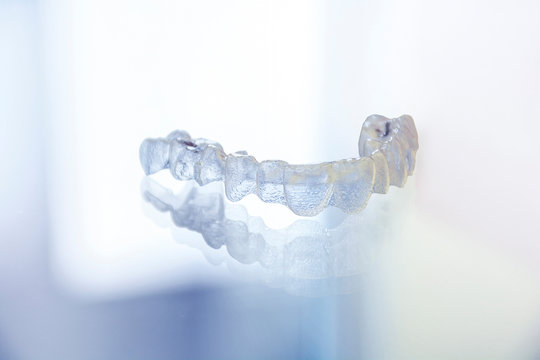 Zahnschiene dental splint im 3D-Druck aus Kunststoff hergestellt zur Zahnkorrektur oder als Aufbiss- Schiene vom Zahnarzt Dentallabor - Bruxismus