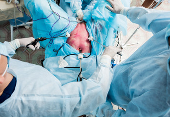 Process of gynecological surgery operation using laparoscopic equipment. Group of surgeons in operating room with surgery equipment.