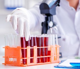 Female scientist researcher conducting an experiment in a labora