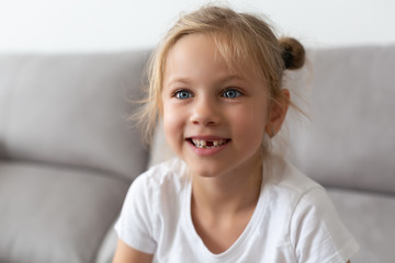 A school-age girl without a front tooth is laughing. Close-up. Change of teeth