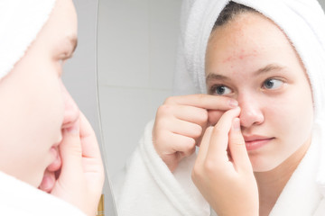 girl with a towel on her head in the morning in front of a mirror squeezes a pimple