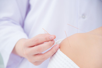 Close up of hands doing acupuncture with at patient shoulder ,Alternative medicine concept.