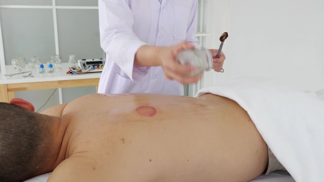 Therapist giving vacuum cupping therapy to man's back in the clinic.Chinese Traditional treatment. Medical cupping therapy.