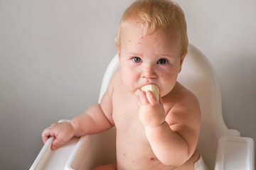 The child is sick with varicella. Measles. The child sits in a feeding chair and eats a banana. Food allergy. No vaccination.