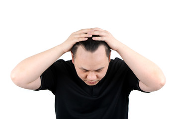 Close up of serious Asian bald man alopecia isolated on white background. Human hair loss solution concept.