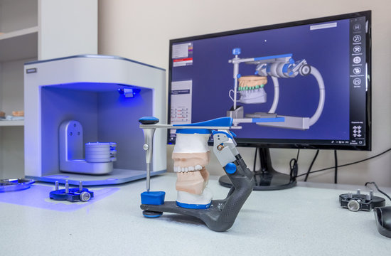 3D scanner and PC in the process of creating dentures