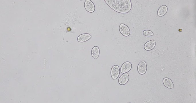 Paramecium caudatum is a genus of unicellular ciliated protozoan and Bacterium under the microscope.