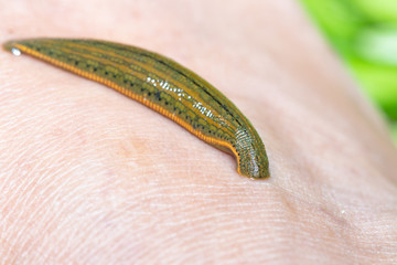Aquatic Leech sucking blood on skin,Leeches were used in medicine from ancient