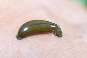 Aquatic Leech sucking blood on skin,Leeches were used in medicine from ancient