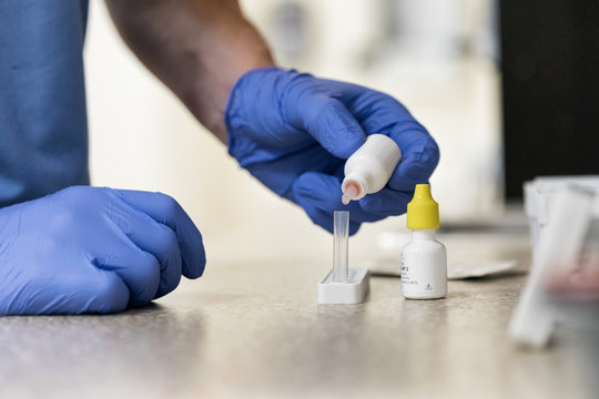 Clinic: Medical Tech Runs Strep Test On Patient Sample