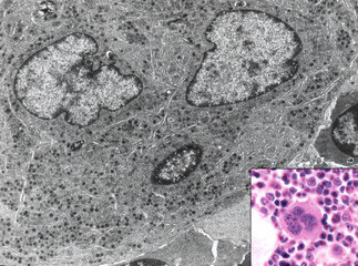 Bone marrow. Megakaryocyte