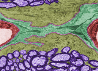Glial limiting membrane
