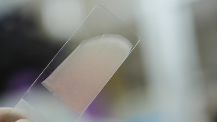 Blood smear on blur background.