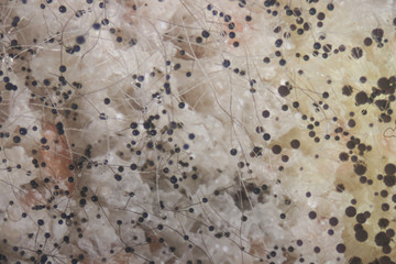 Backgrounds Colony Characteristics of Rhizopus (bread mold) is a genus of common saprophytic fungi,...