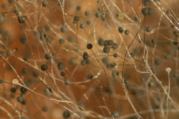 Backgrounds Colony Characteristics of Rhizopus (bread mold) is a genus of common saprophytic fungi, Rhizopus (bread mold) under the microscope.(soft focus and have Grain/Noise)