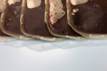 Blood in the blood bag on the table in the laboratory