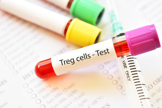 Blood sample tube for Regulatory T cells or Treg cells test