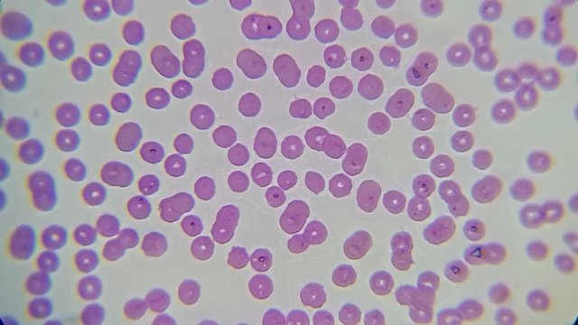 blood smear : Red blood cells from a dog suspected of babesiosis under a microscope	