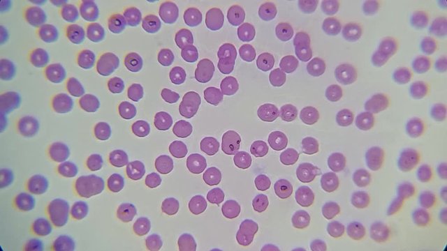 blood smear : Red blood cells from a dog suspected of babesiosis under a microscope 