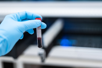 Close up scientist hand holding blood test tube during prepare specimen for auto machine analysis.