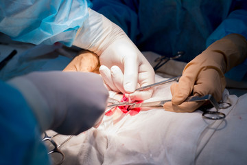 surgical suture. The hands of the surgeon and assistant in a sterile operating room impose a...