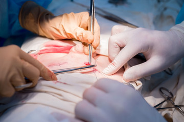 Obraz na płótnie Canvas surgical suture. The hands of the surgeon and assistant in a sterile operating room impose a cosmetic suture on the skin of the patient's child.