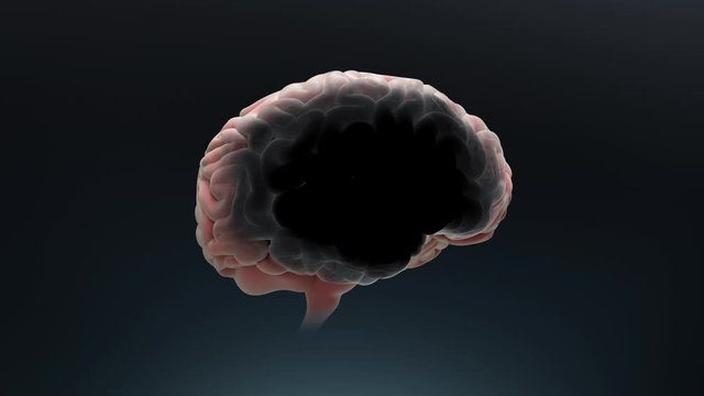 Isolated Brain Rotates with Dark Spots Spreading Showing the Concept of Forgetting and Memory Decay. Brain necrosis animation, 3D model of a brain slowly dies of Alzheimer's Disease